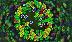 Microscopy imaging from Leone Lab